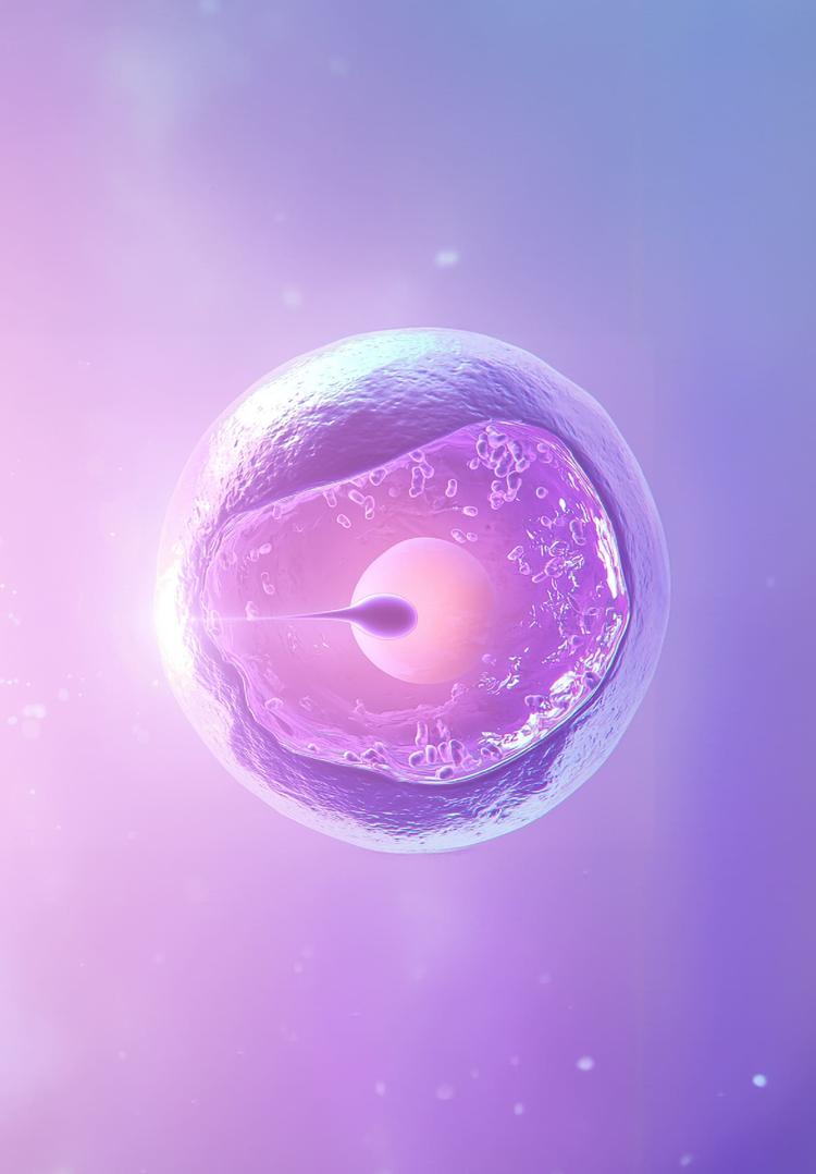IVF