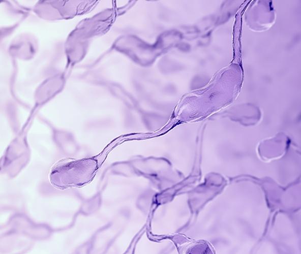 Sperm dysfunction