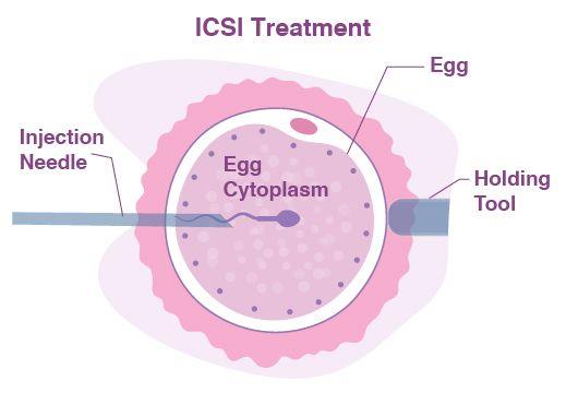 treatment image