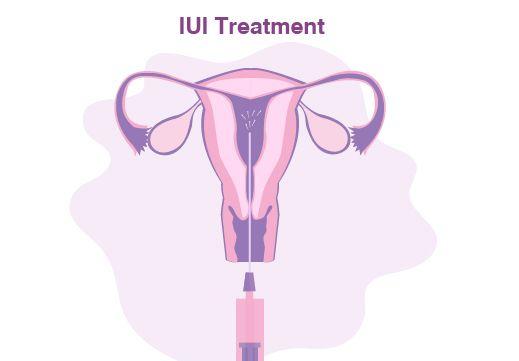 treatment image