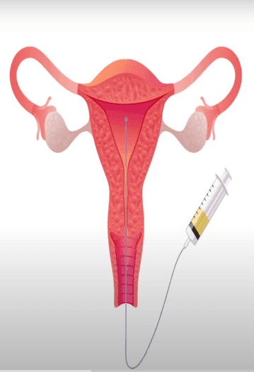 pregnancyplan1