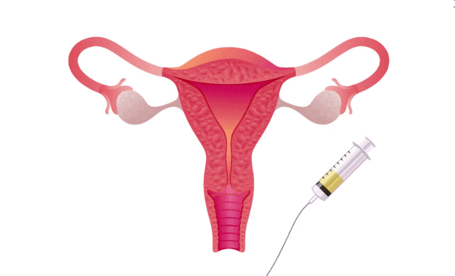 pregnancyplan1